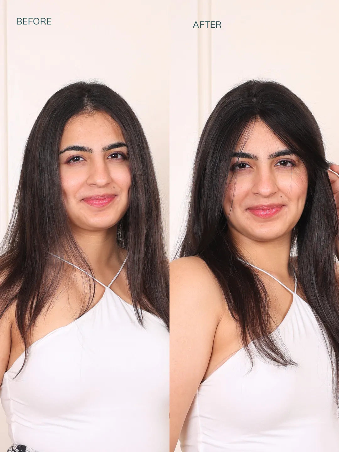 Front Hairline Patch Before & After Images
